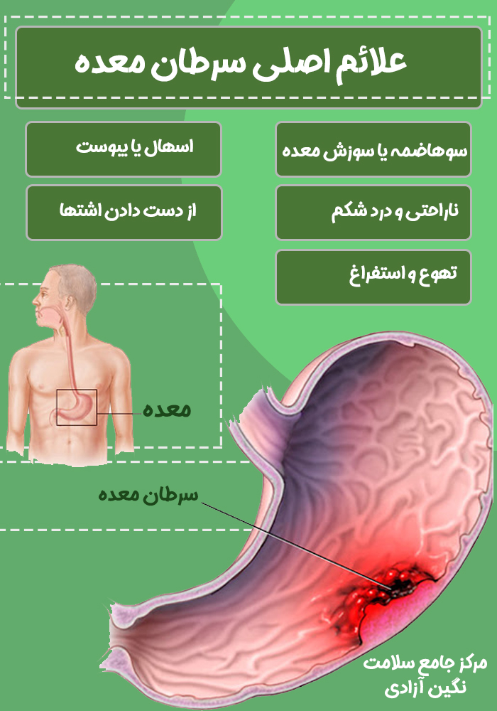 علائم سرطان معده