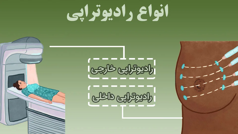 انواع پرتودرمانی
