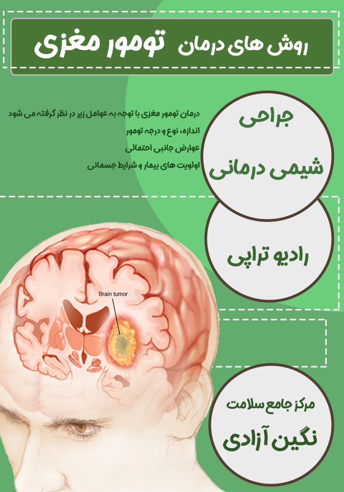 درمان تومور های مغزی