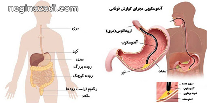 آندوسکوپی مجاری گوارشی