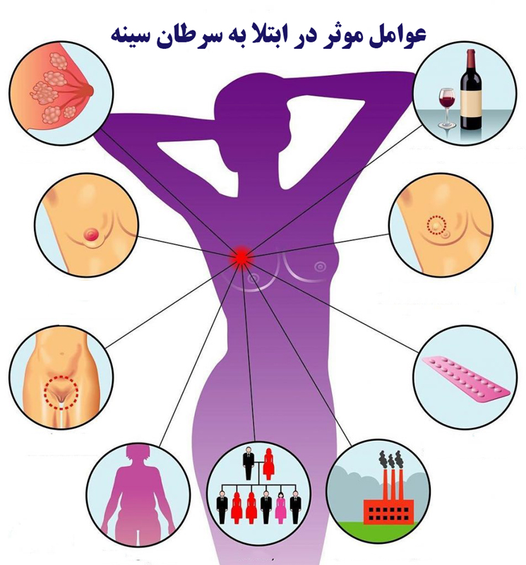 خطر سرطان سینه
