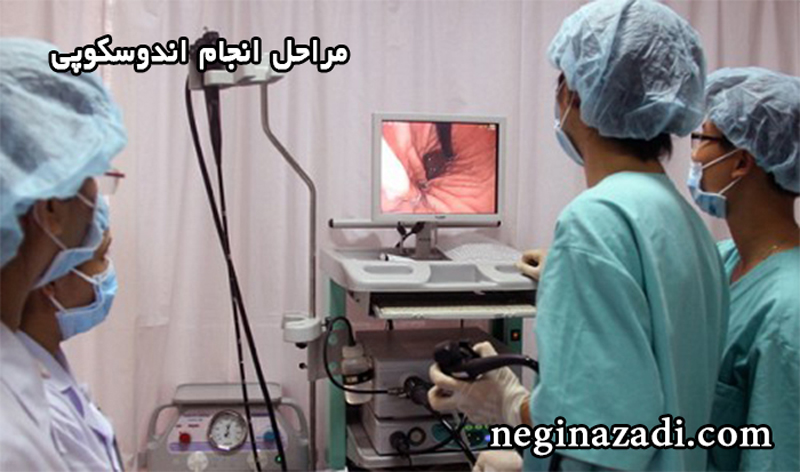 مراحل انجام اندوسکوپی